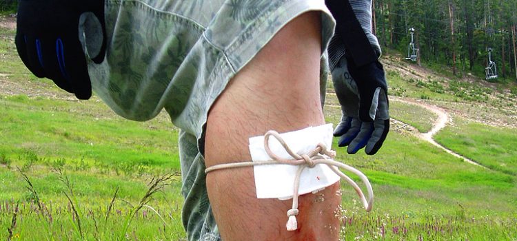 Wilderness First Aid – September 2019